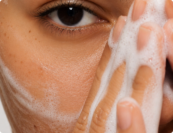 Gently cleanse skin with warm water or a natural cleanser