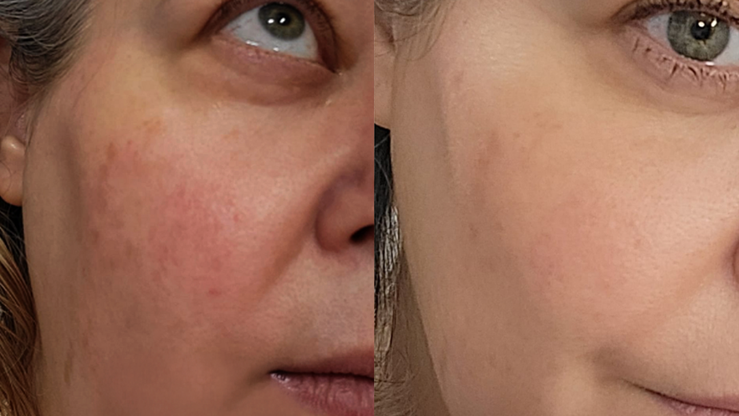 F-Balm - Anti-Woke, Non-Vegan, All-In-One Skincare