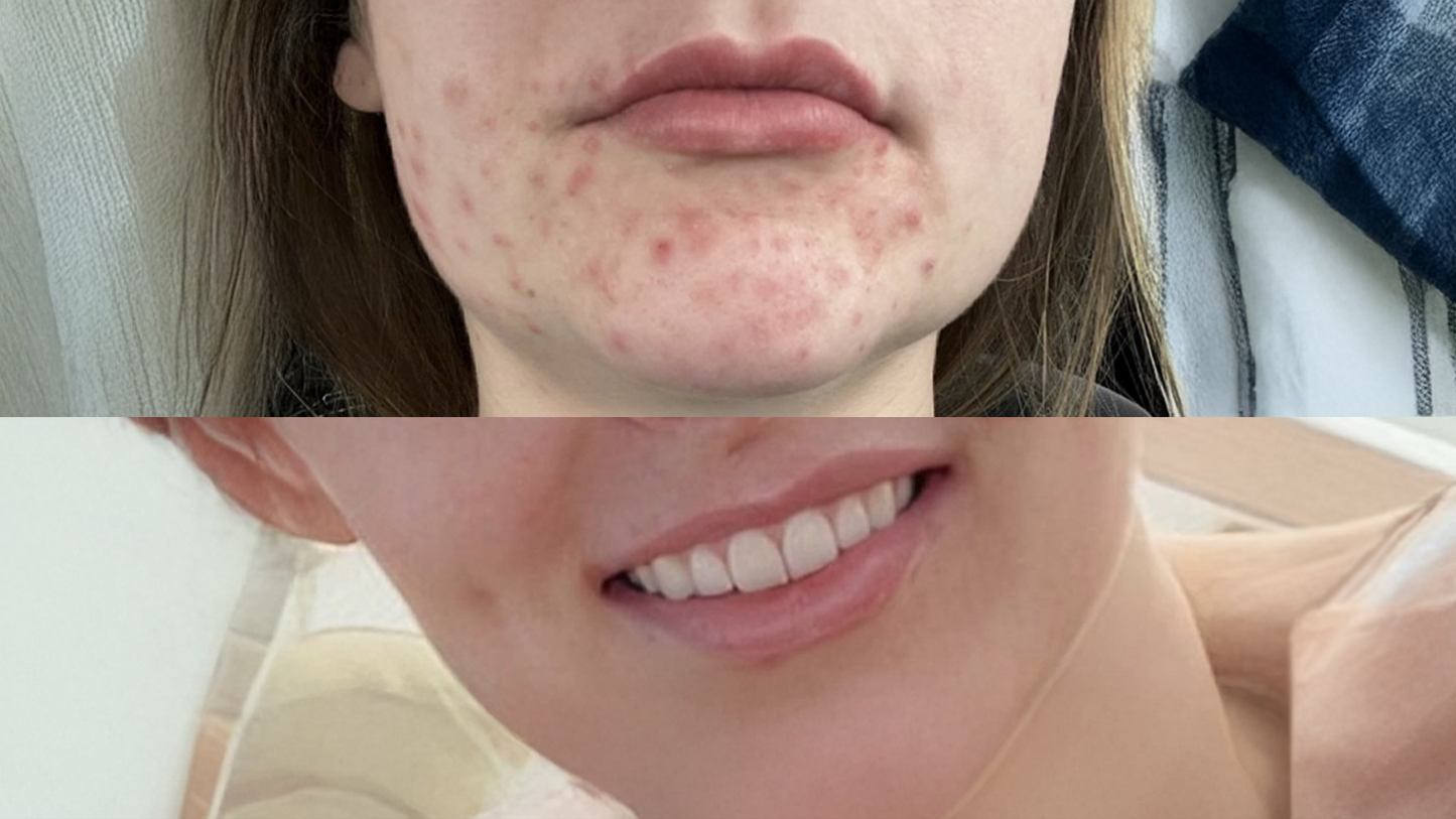 F-Balm - Anti-Woke, Non-Vegan, All-In-One Skincare